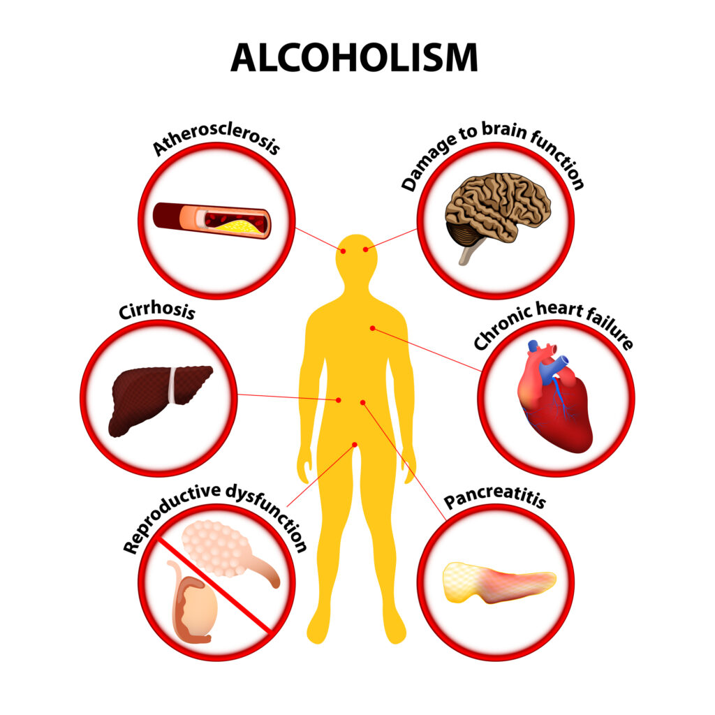 How Does Alcohol Affect My Health?