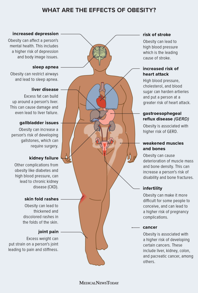 What Are The Health Risks Of Obesity?
